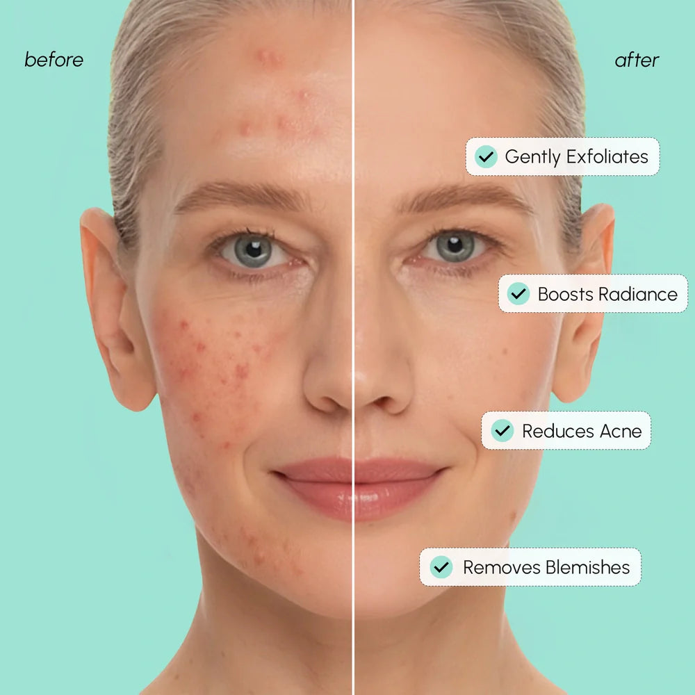 Marée® Azelaic Acid Pads – Brightening & Blemish-Reducing Toner Pads