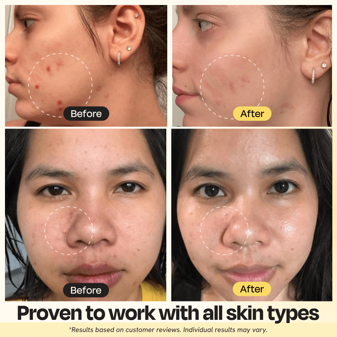 Gleamin 3-in-1 Kurkuma aufhellende Gesichtsmaske | 10-Minuten-Naturbehandlung