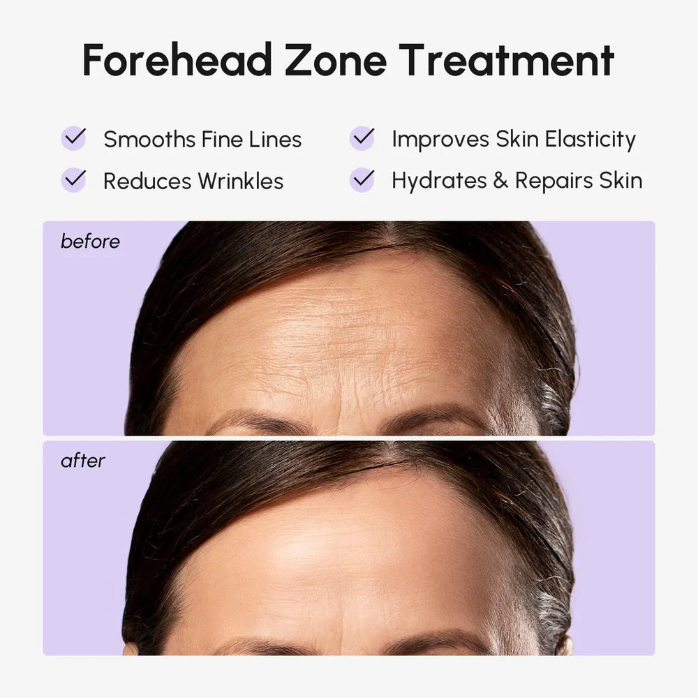 Marée® Forehead Wrinkle Patches