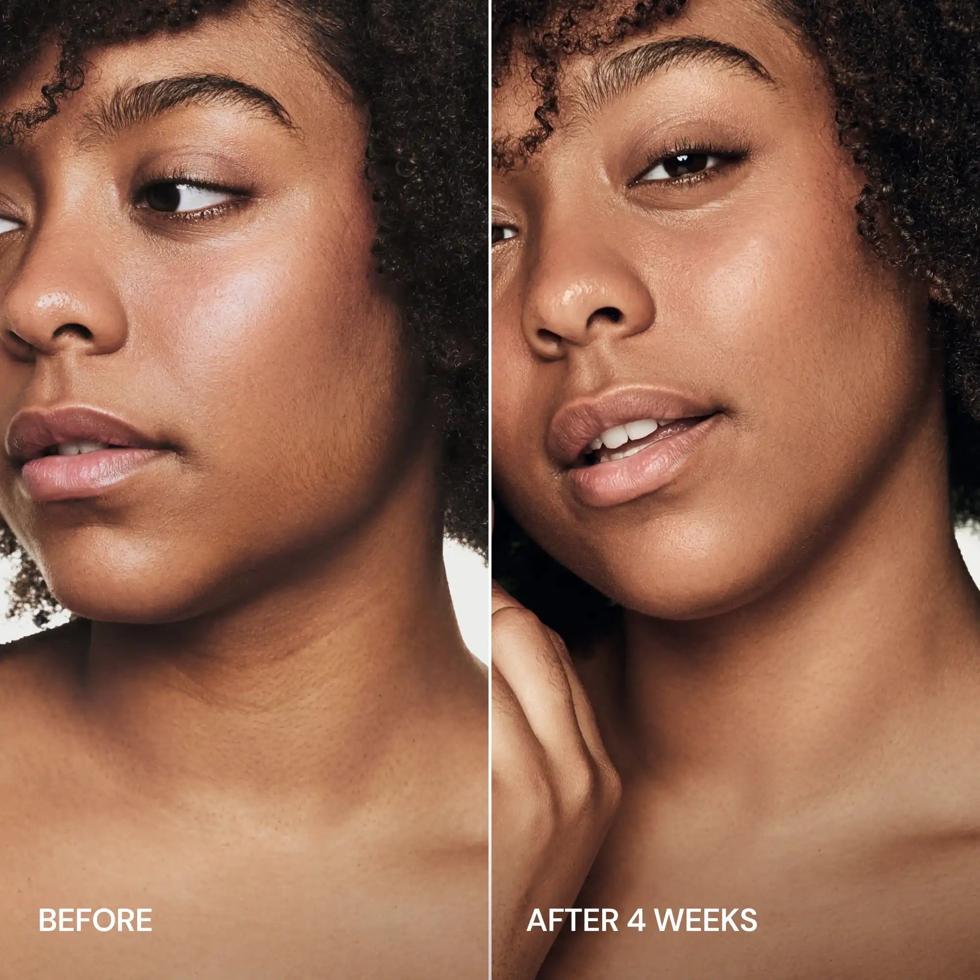 24K Gold V-Line Lifting Mask | Jawline Sculpting, Hydrating & Firming
