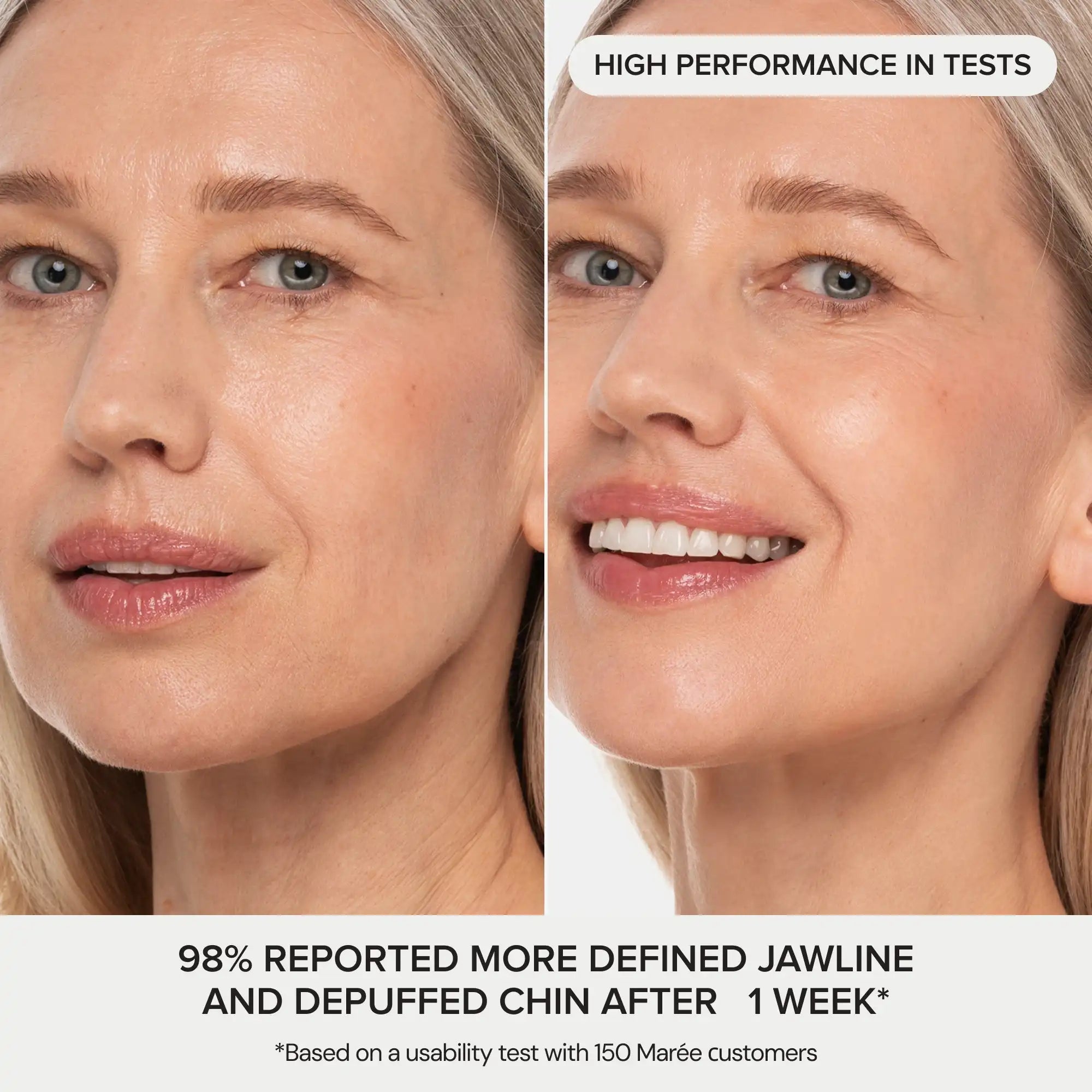 24K Gold V-Line Lifting Mask | Jawline Sculpting, Hydrating & Firming