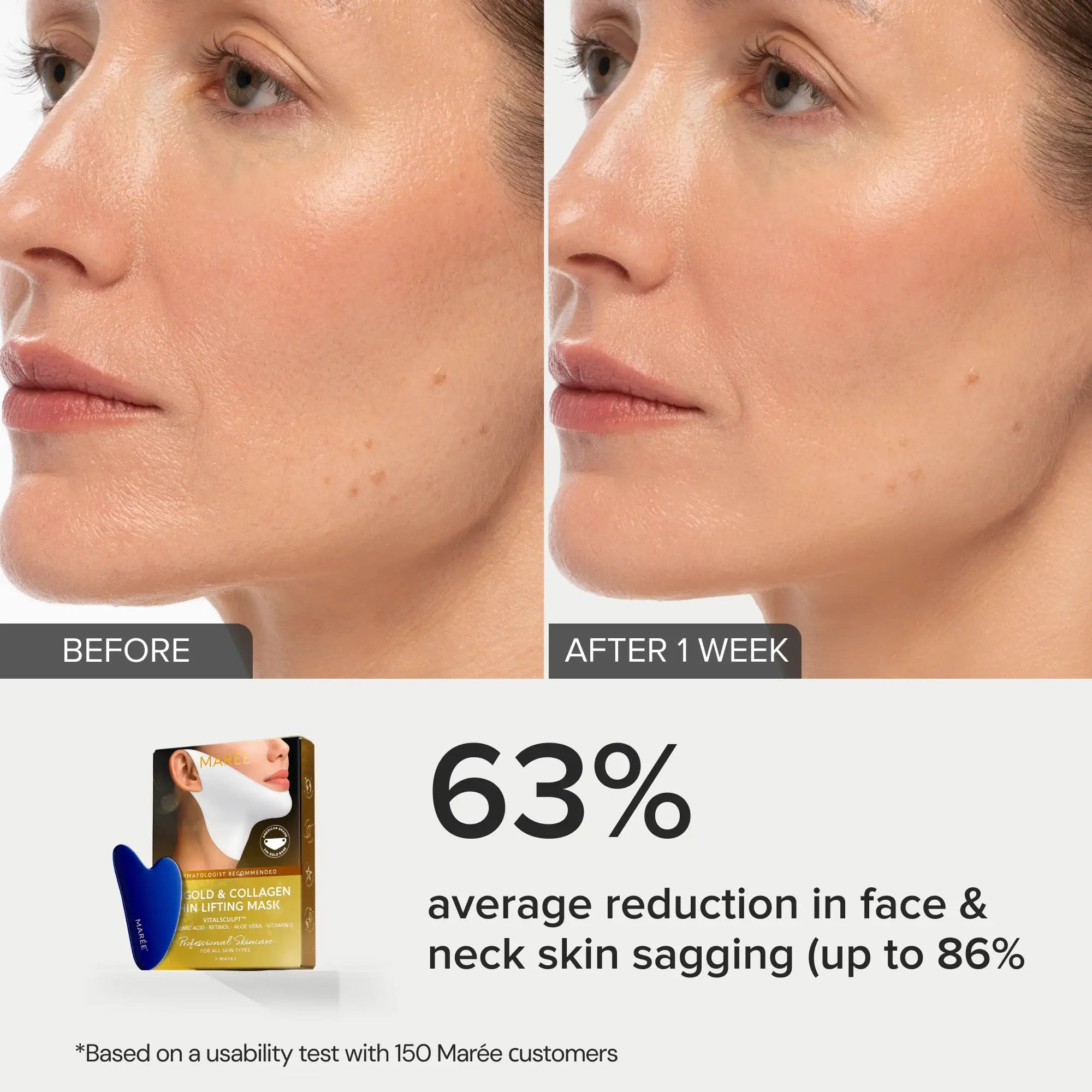 24K Gold V-Line Lifting Mask | Jawline Sculpting, Hydrating & Firming