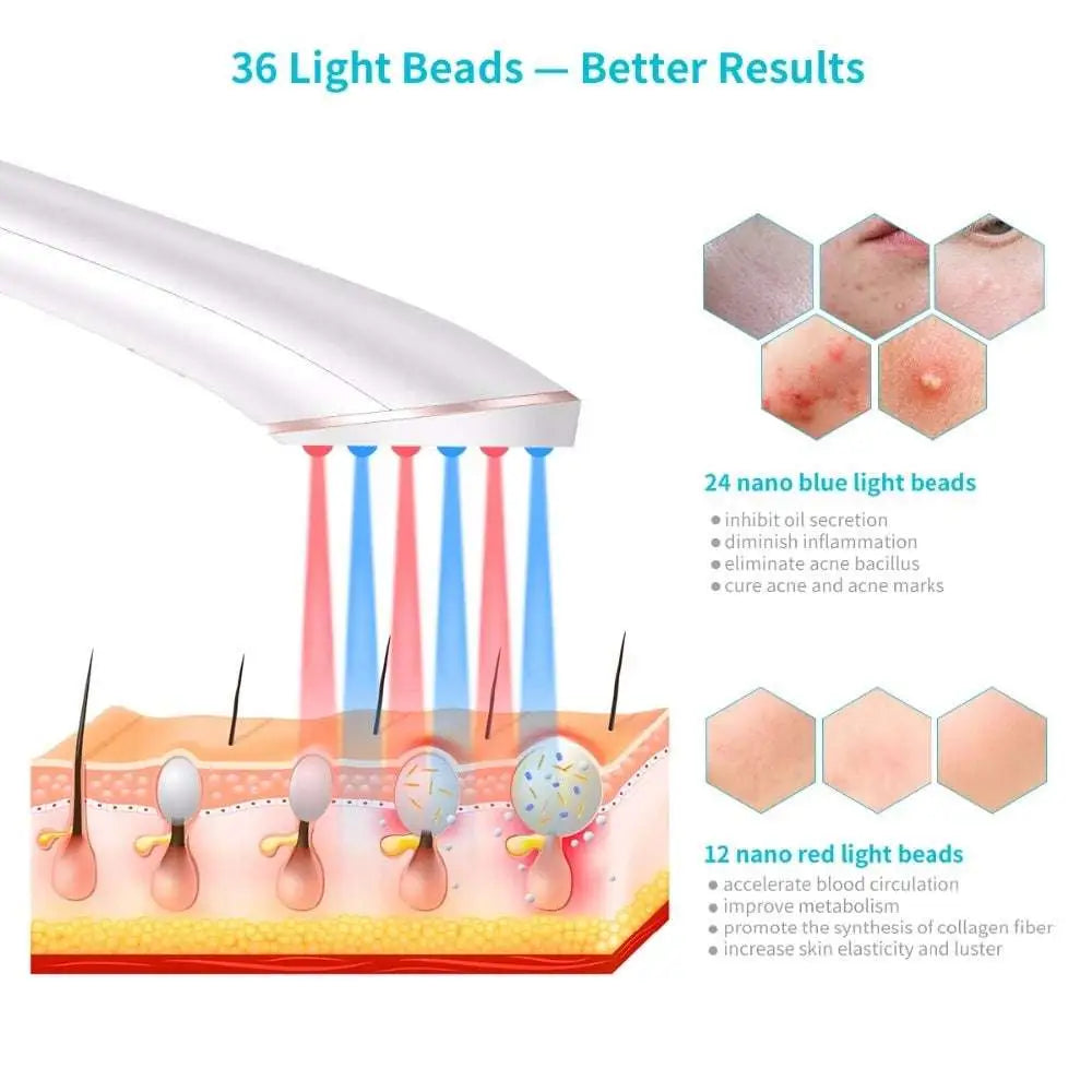 36-Bead LED Light Therapy Device | Blue & Red Light, Wireless Charging, Acne & Skin Rejuvenation
